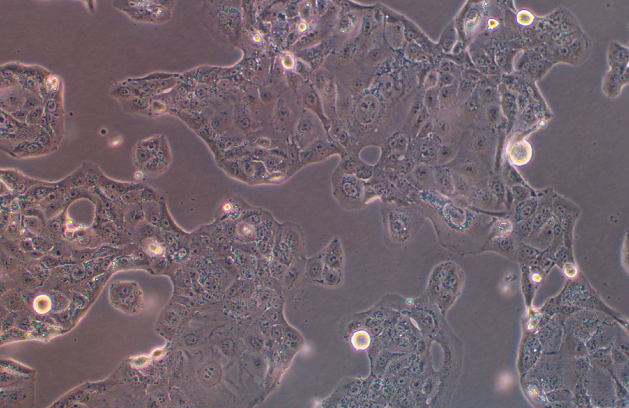 人肺乳頭狀腺癌細胞NCI-H820(STR鑒定正確)