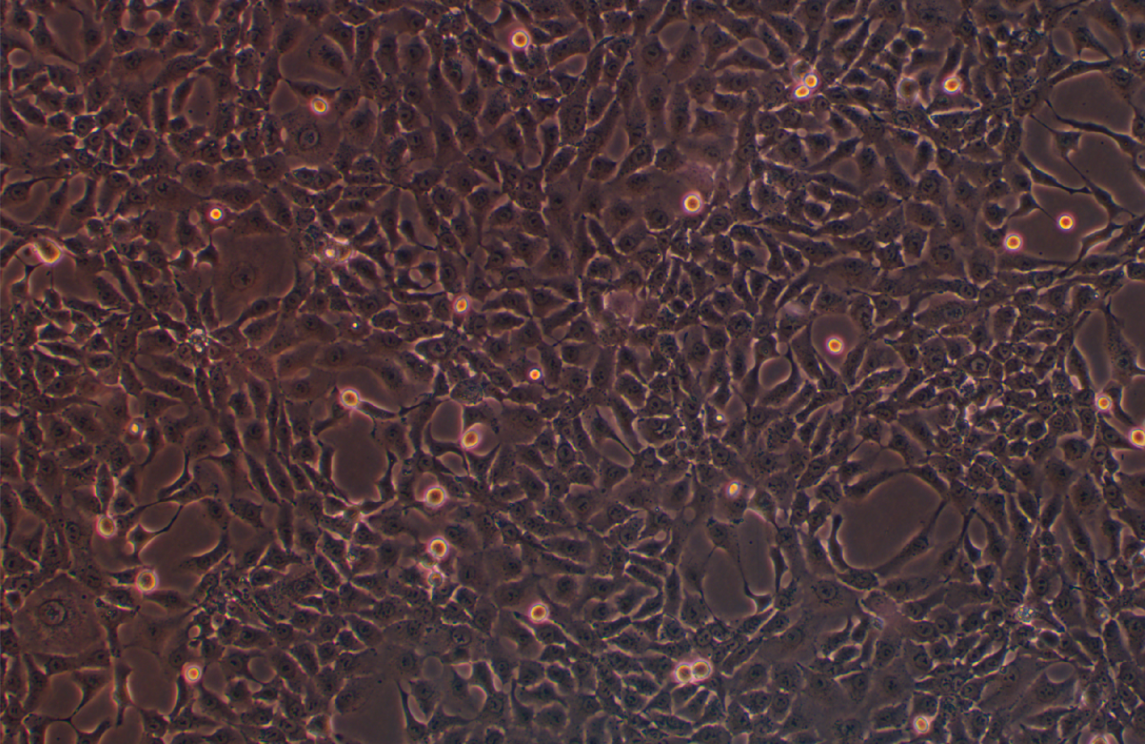 人肺腺癌細胞 NCI-H2009(STR鑒定正確)