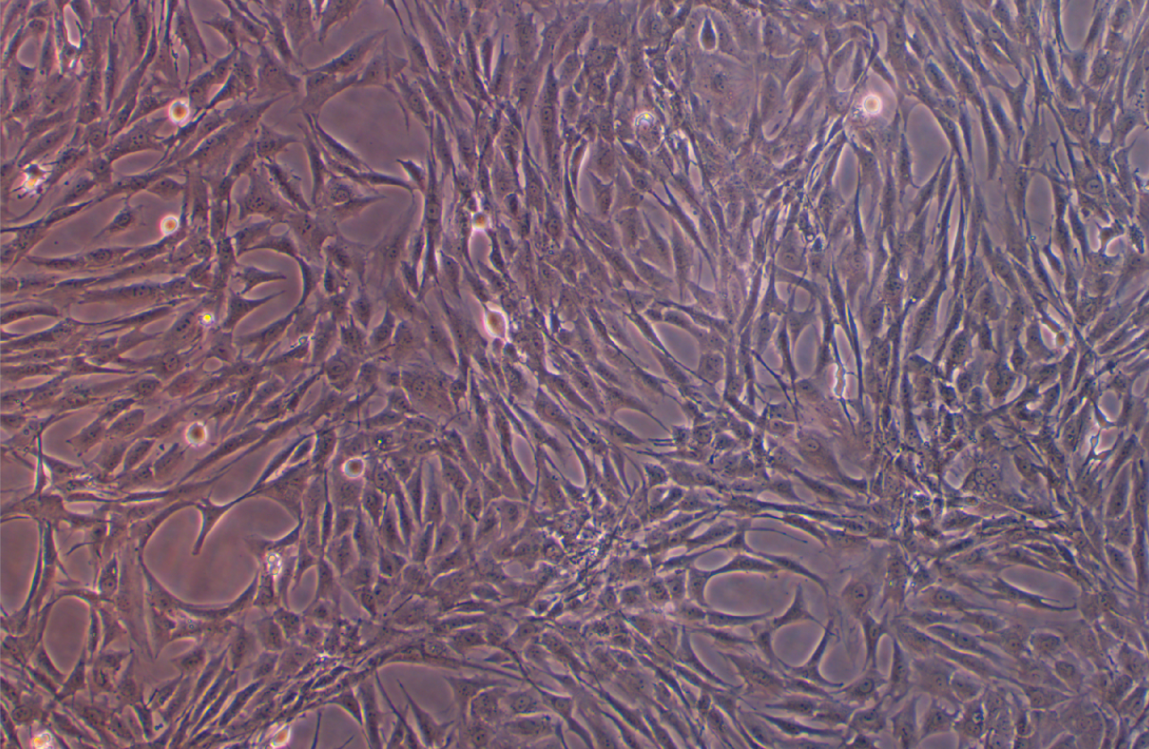 人皮膚成纖維HDF-a(STR鑒定正確)