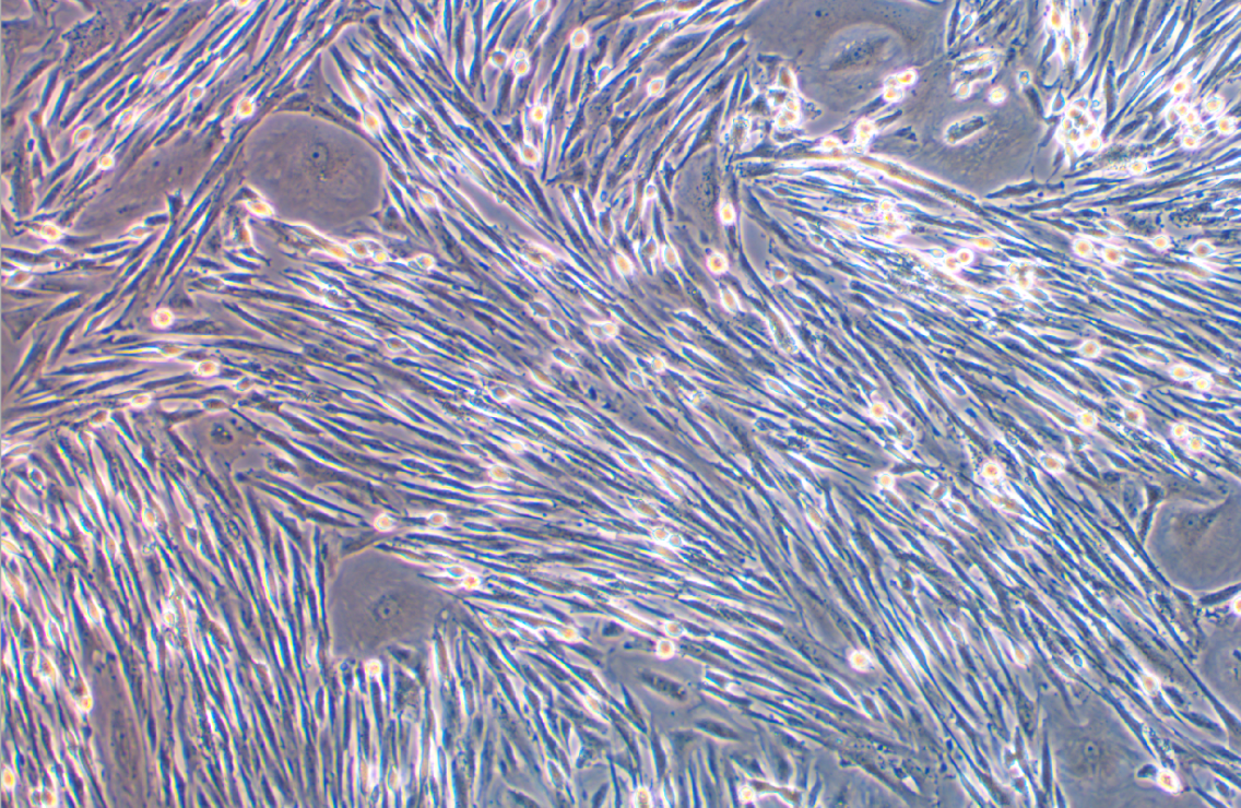 狗肺成纖維細胞(免疫熒光鑒定)