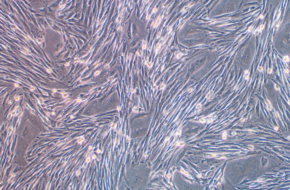 狗肺成纖維細胞(免疫熒光鑒定)