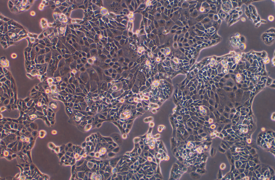 人胰腺癌細(xì)胞Panc 10.05(STR鑒定正確)