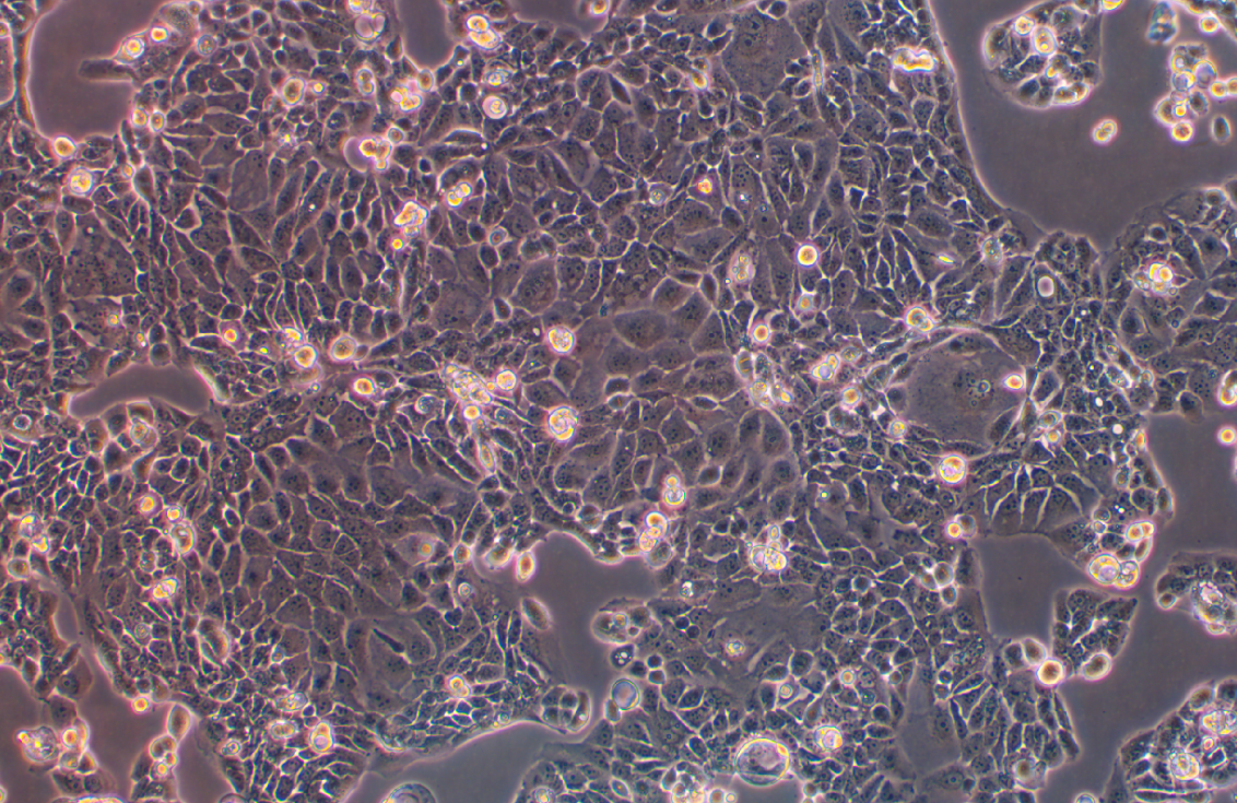 人胰腺癌細(xì)胞Panc 10.05(STR鑒定正確)