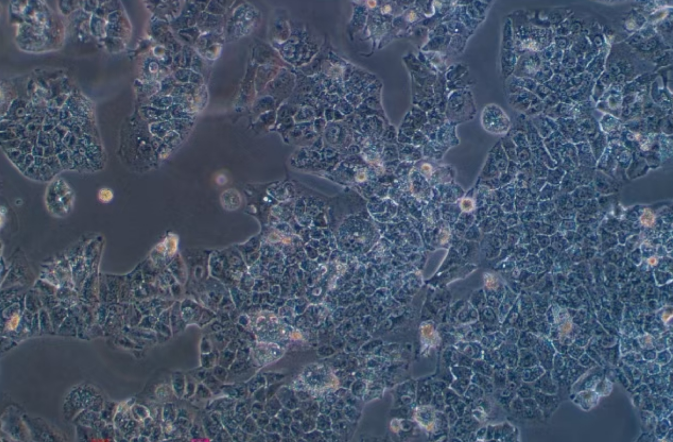 人肝癌細胞HuH-1(STR鑒定正確)