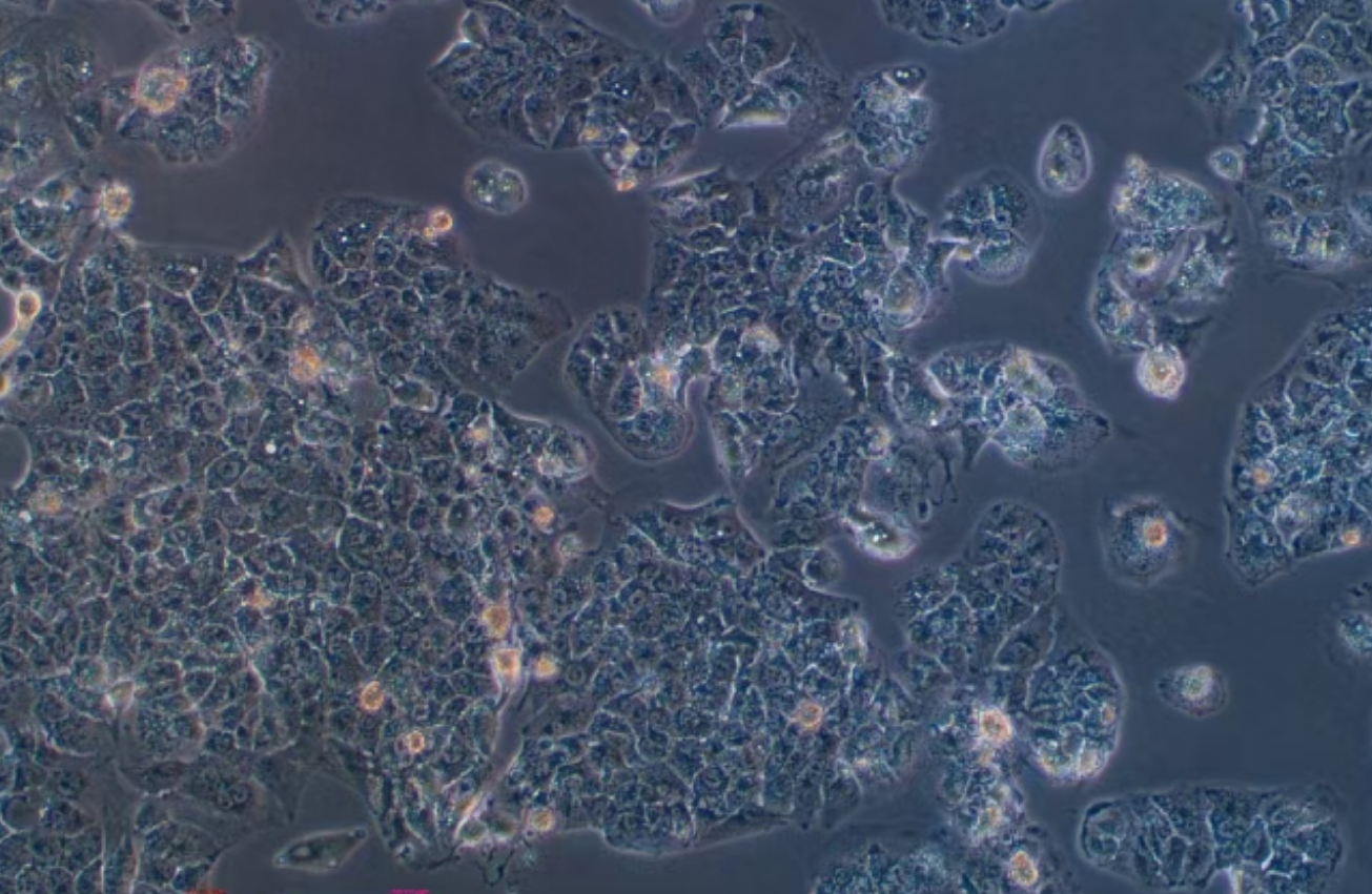 人肝癌細胞HuH-1(STR鑒定正確)