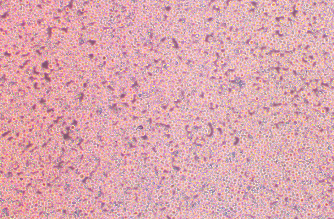 人多發性骨髓瘤細胞MOLP-8(STR鑒定正確)