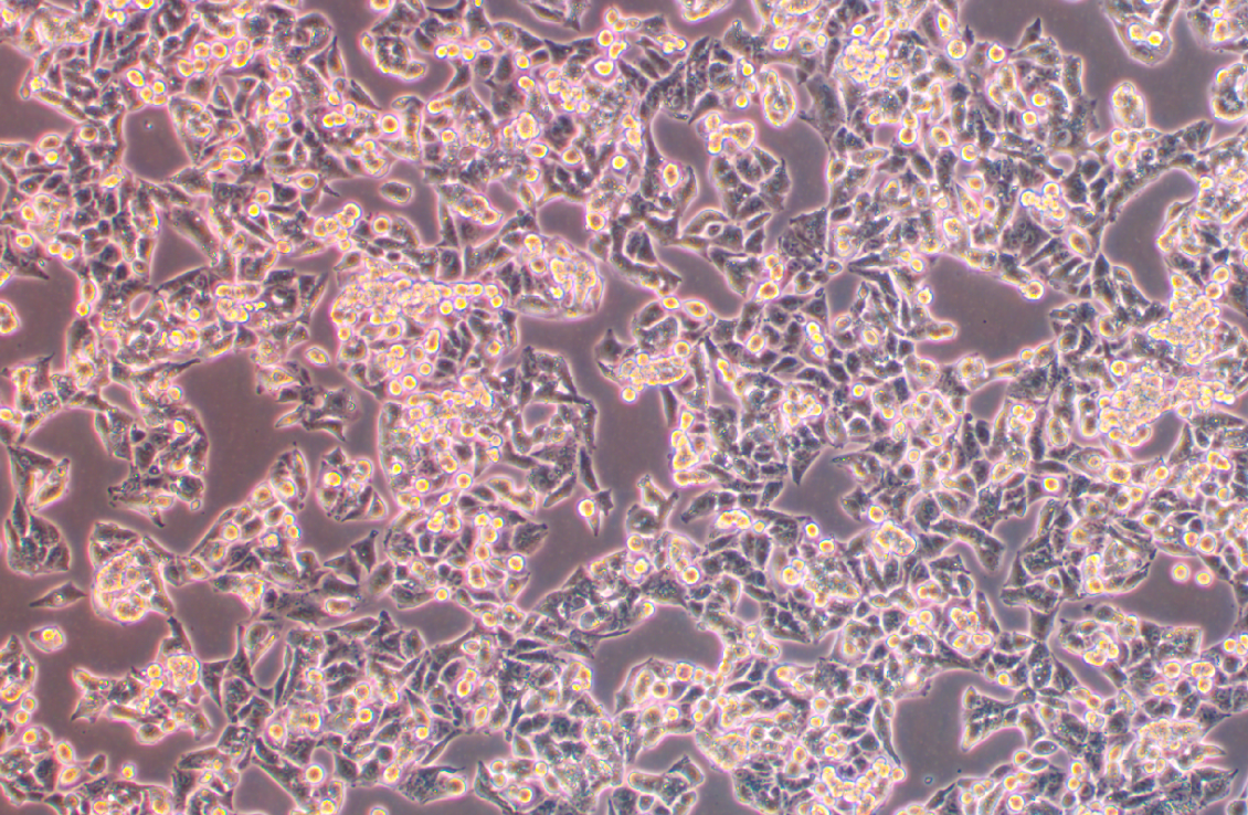 人肝癌細(xì)胞系HepAD38(STR鑒定正確)