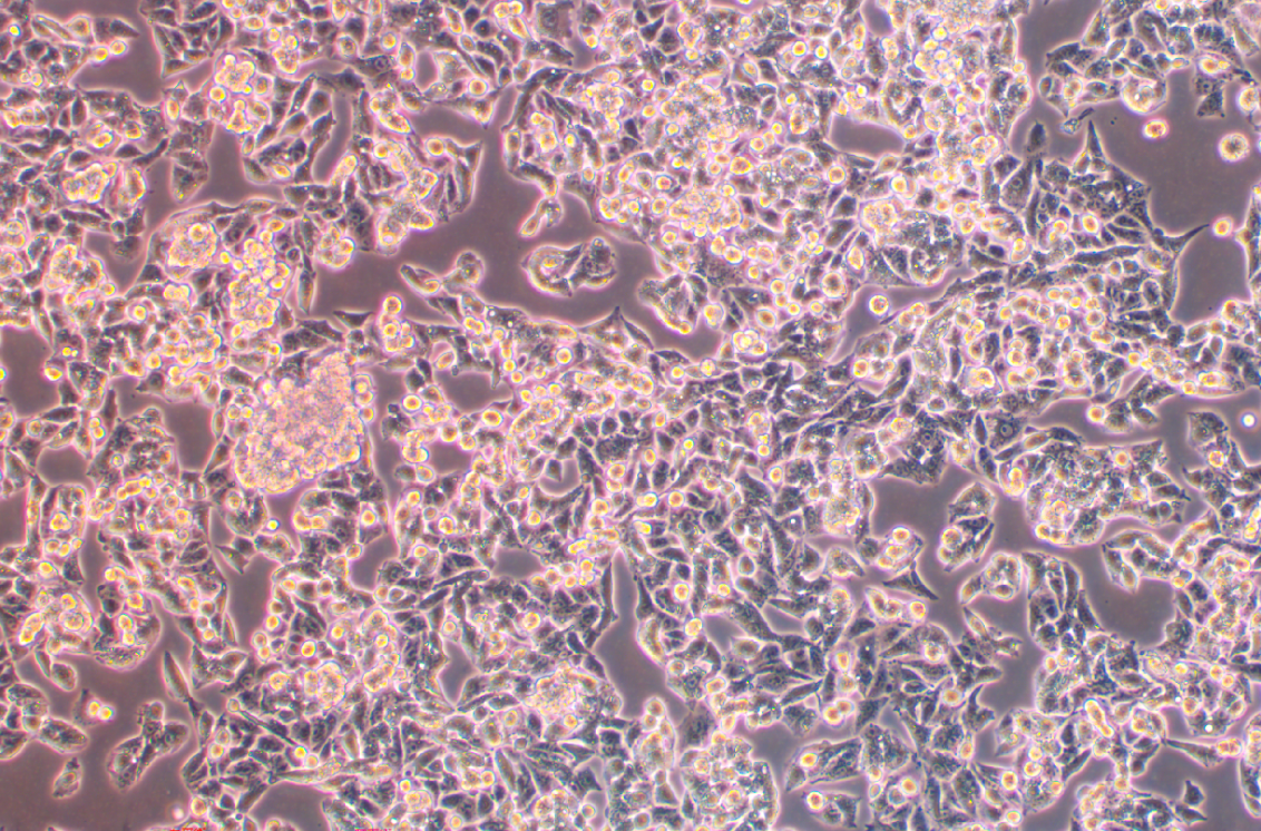 人肝癌細(xì)胞系HepAD38(STR鑒定正確)