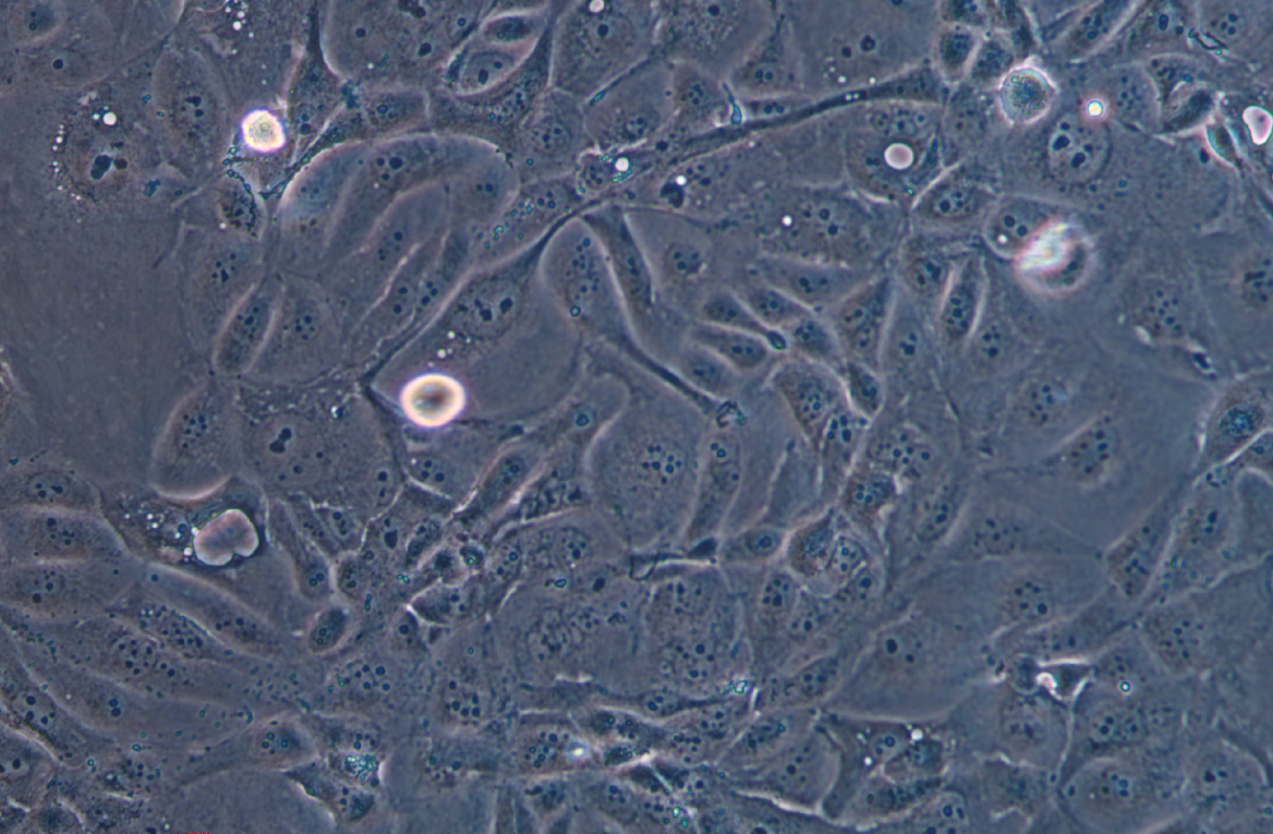 人胰腺癌吉西他濱耐藥株SW1990/G(STR鑒定正確)