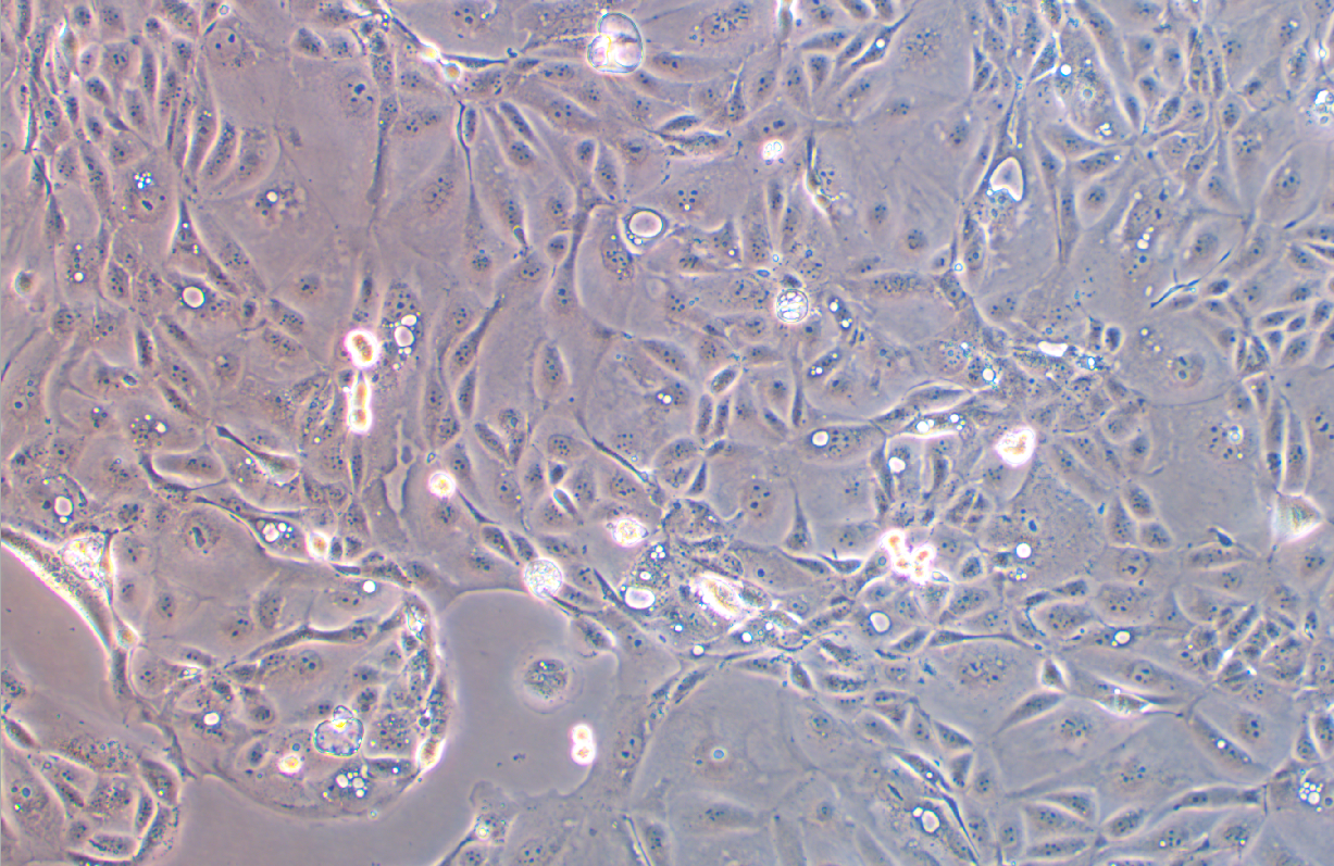 人胰腺癌吉西他濱耐藥株SW1990/G(STR鑒定正確)
