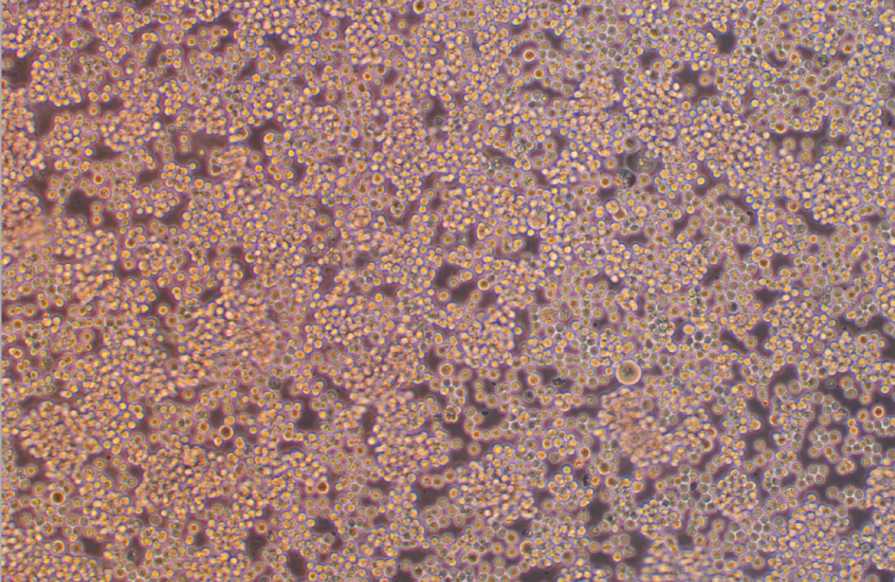 人Burkitt’s淋巴瘤細胞RAJI (STR鑒定正確)