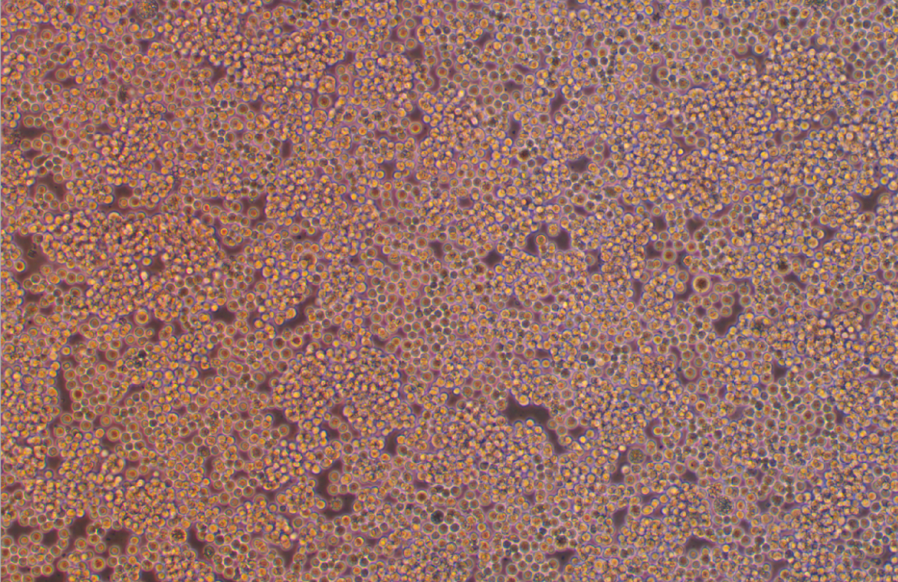 人Burkitt’s淋巴瘤細胞RAJI (STR鑒定正確)