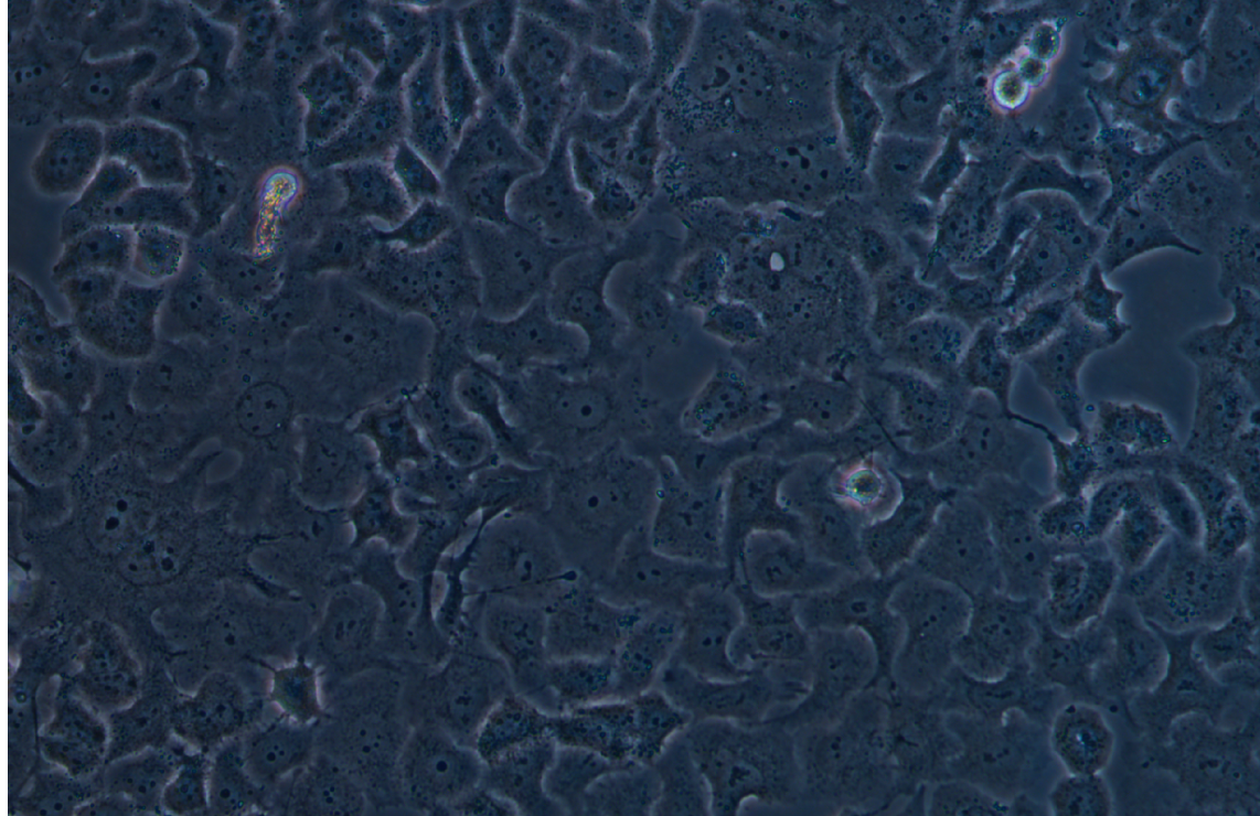 人非小細胞肺癌腺癌細胞NCI-H522 (STR鑒定正確)