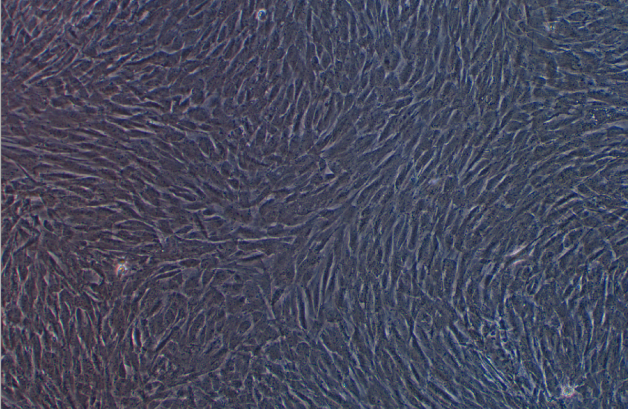 人子宮內(nèi)膜異位癥上皮細(xì)胞