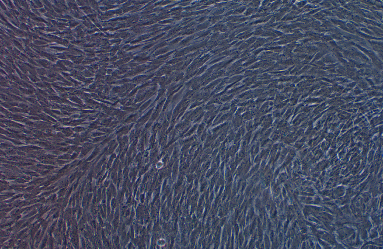 人子宮內(nèi)膜異位癥上皮細(xì)胞