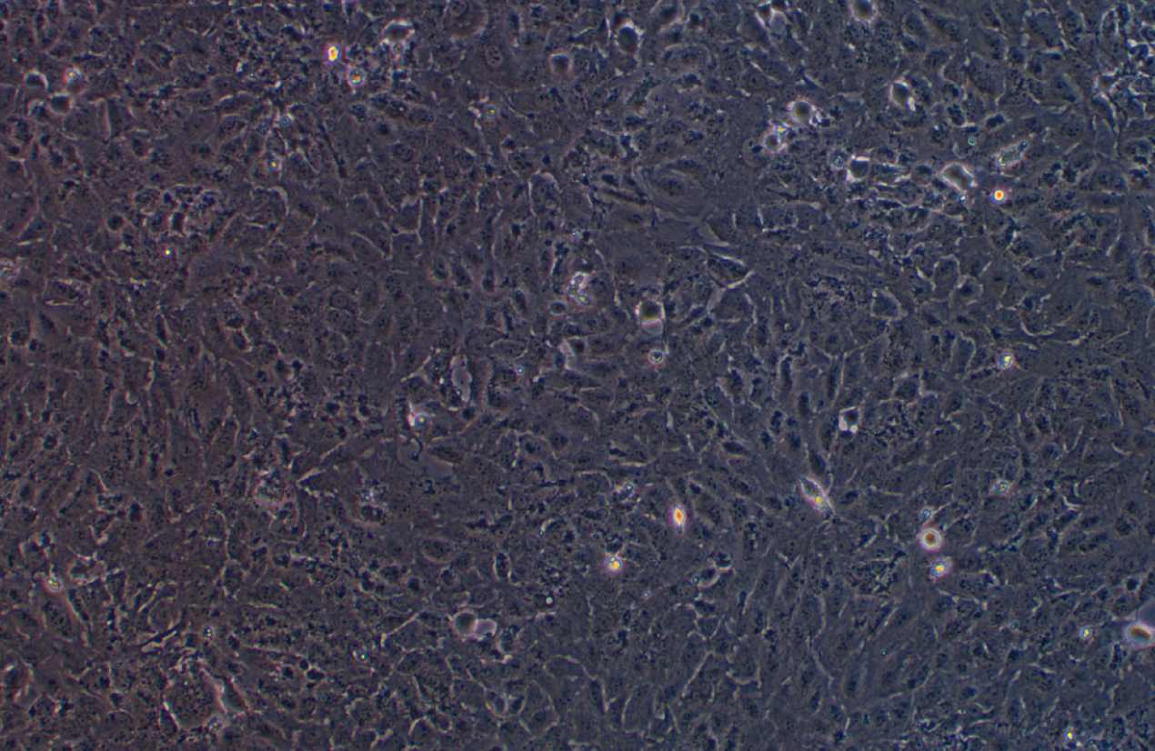 人視網膜色素上皮細胞