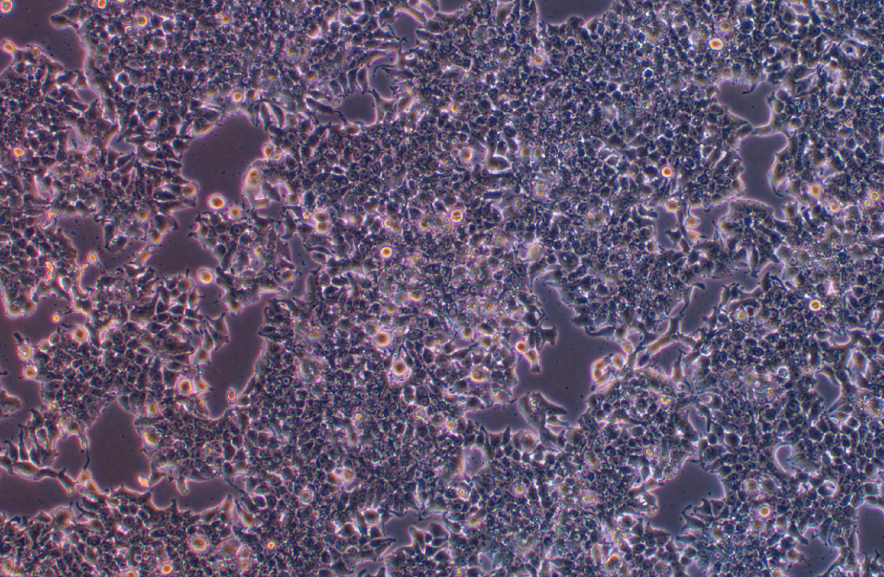 人肺癌細(xì)胞DMS53(STR鑒定正確)