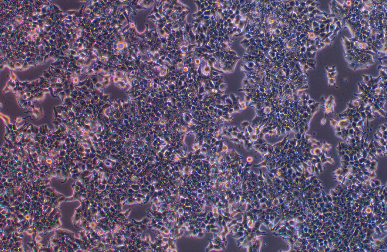 人肺癌細(xì)胞DMS53(STR鑒定正確)