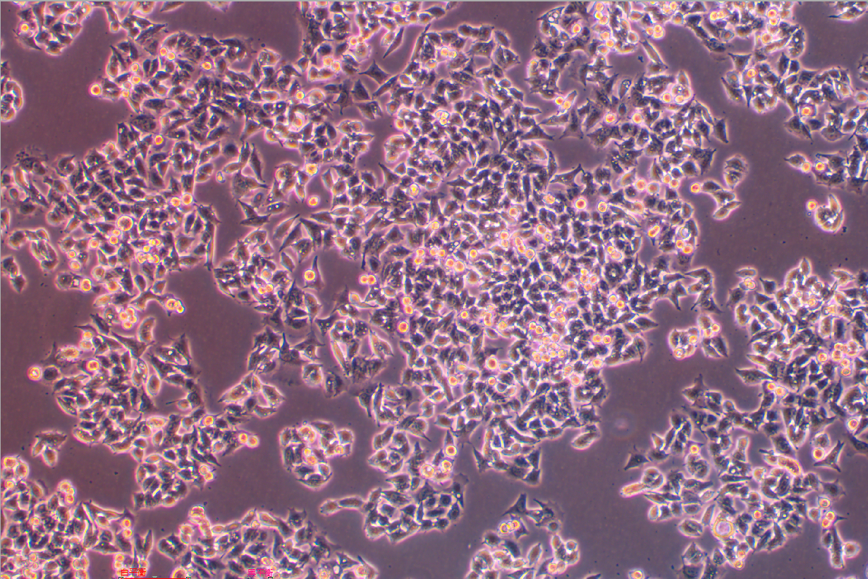 人結直腸腺癌細胞SK-CO-1 (STR鑒定正確)