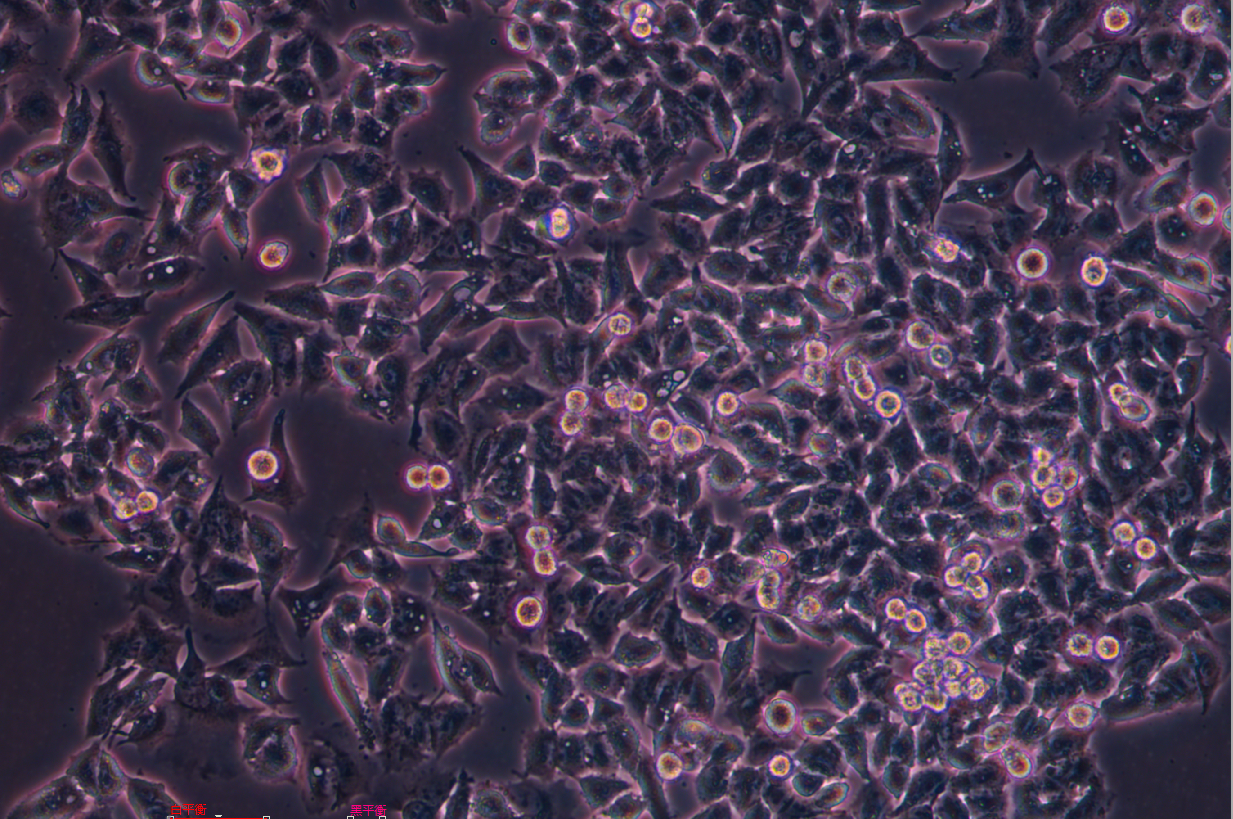 人結直腸腺癌細胞SK-CO-1 (STR鑒定正確)