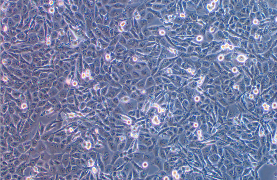 人肺癌腺癌細胞NCI-H1573 (STR鑒定正確)