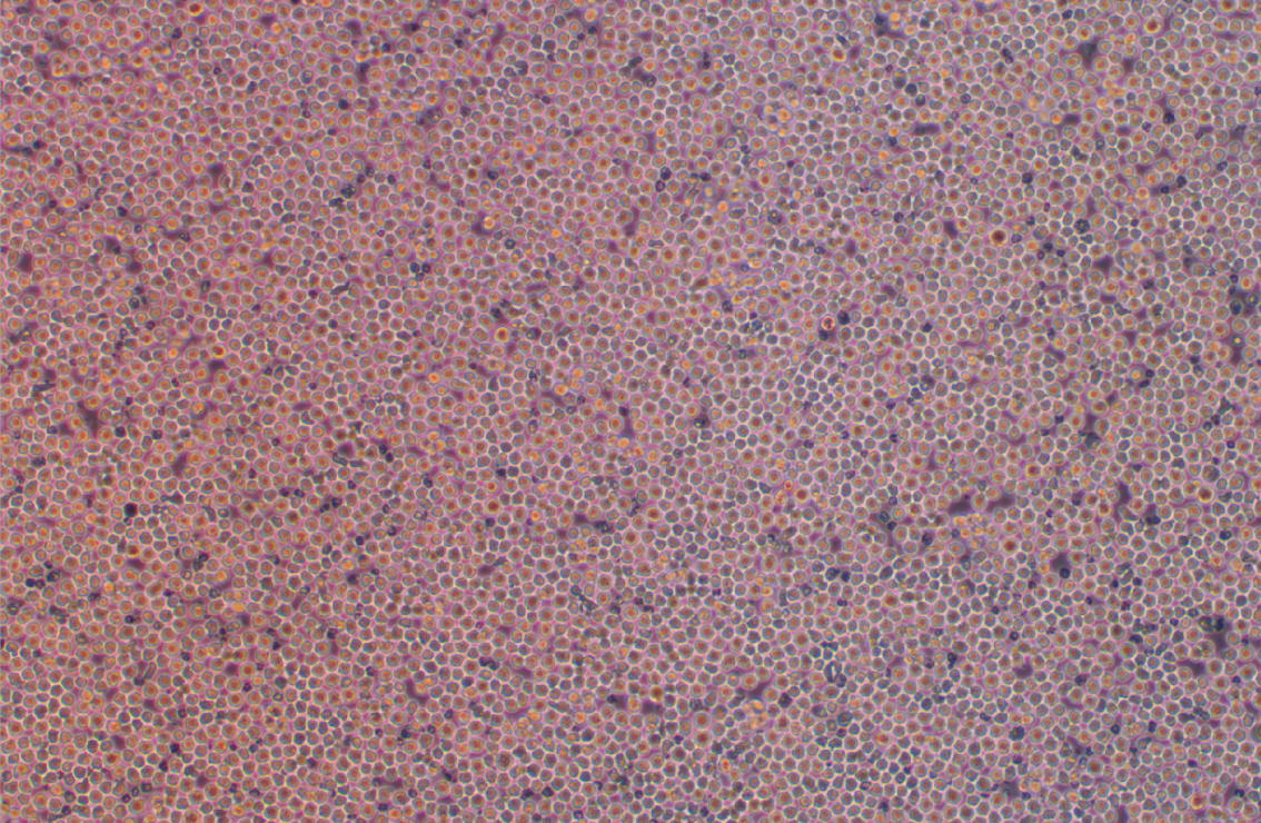 人急性髓性白血病細胞OCI-AML-2(STR鑒定正確)