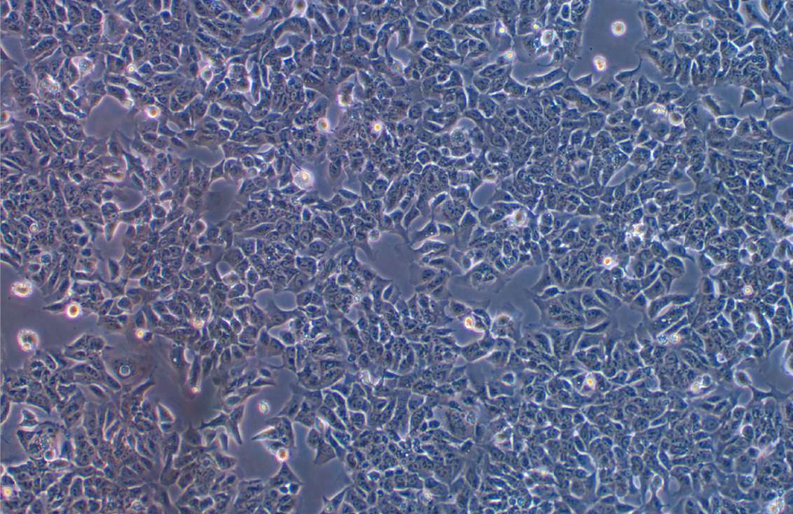 人結直腸腺癌細胞長春新堿耐藥株HCT-8/V(STR鑒定正確)