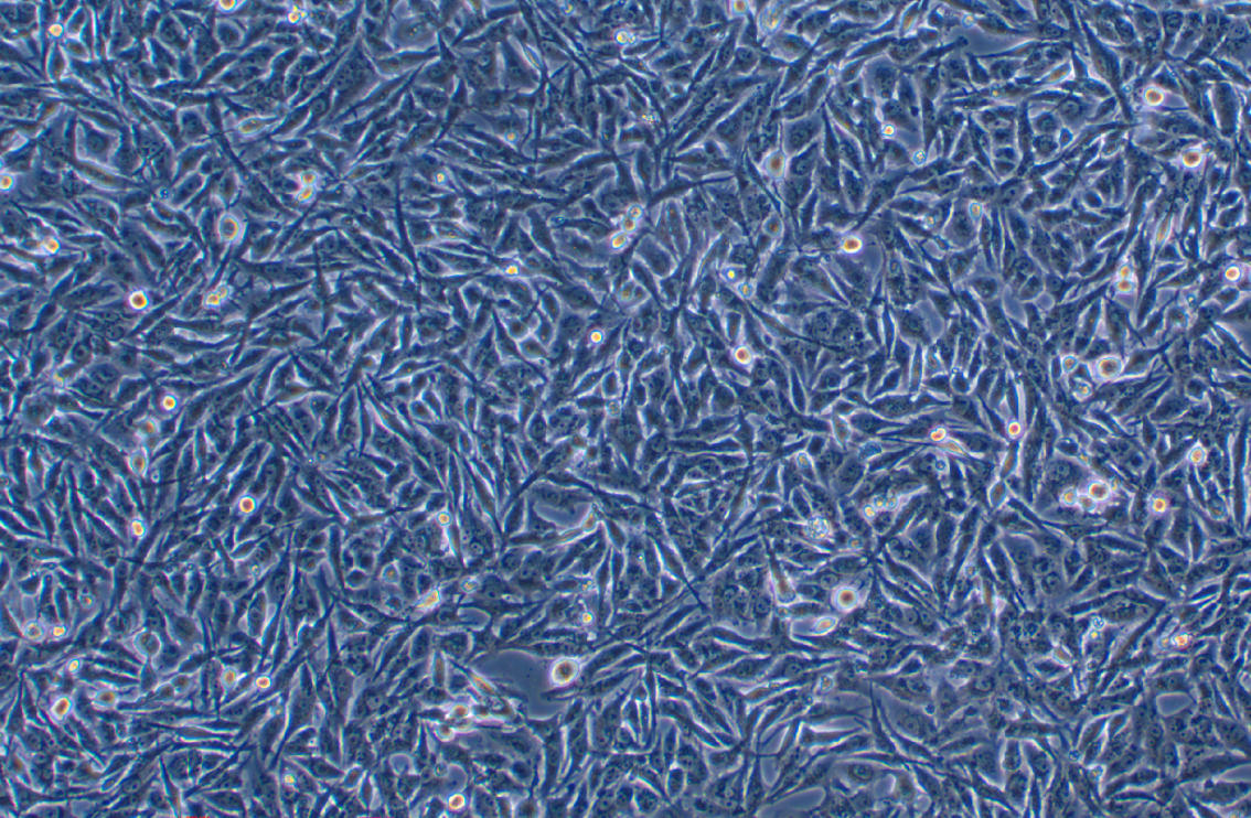 人類星形膠質瘤耐替莫唑胺細胞U251MG/TMZ?(STR鑒定正確)