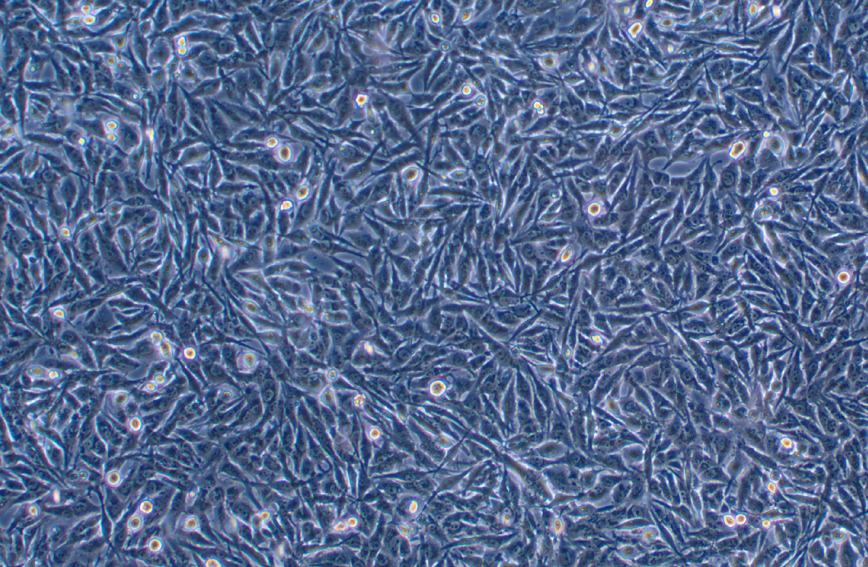 人類星形膠質瘤耐替莫唑胺細胞U251MG/TMZ?(STR鑒定正確)