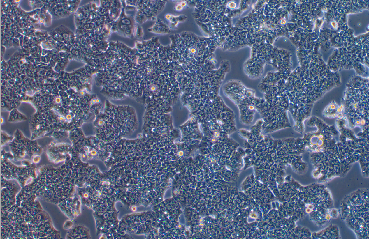 人非小細胞肺癌細胞NCI-H1944(STR鑒定正確)