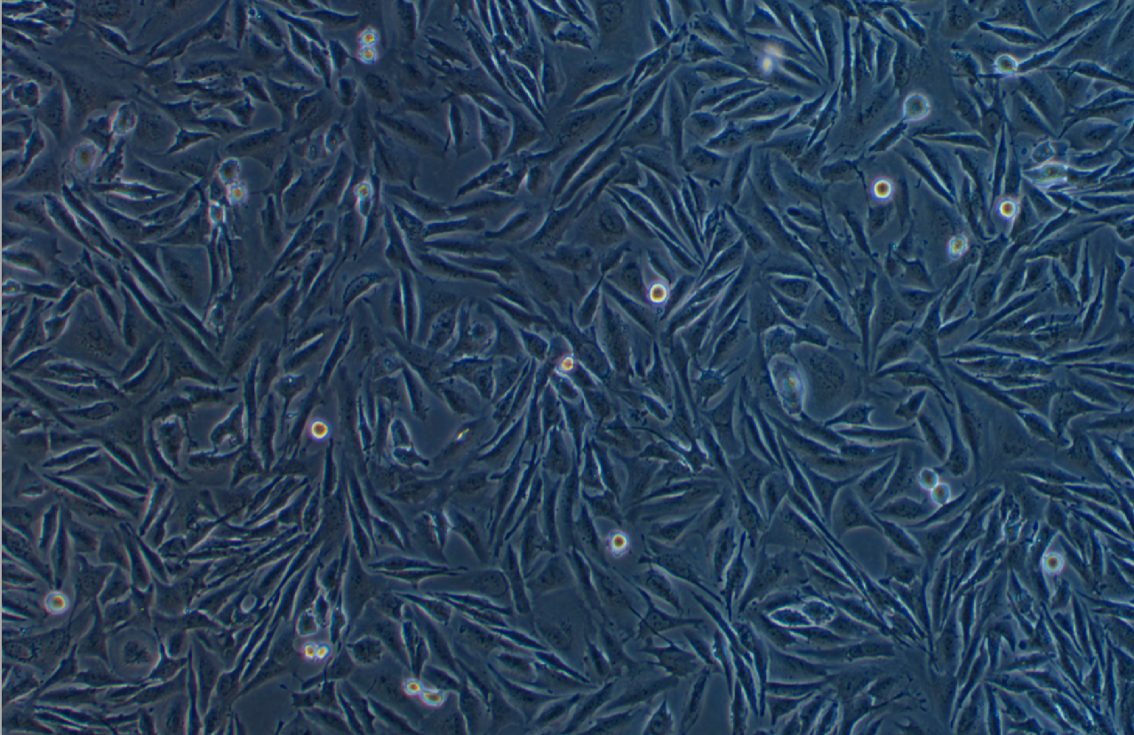 人胃腸道間質瘤細胞GIST-T1 (STR鑒定正確)