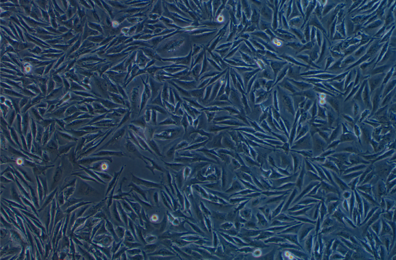人胃腸道間質瘤細胞GIST-T1 (STR鑒定正確)