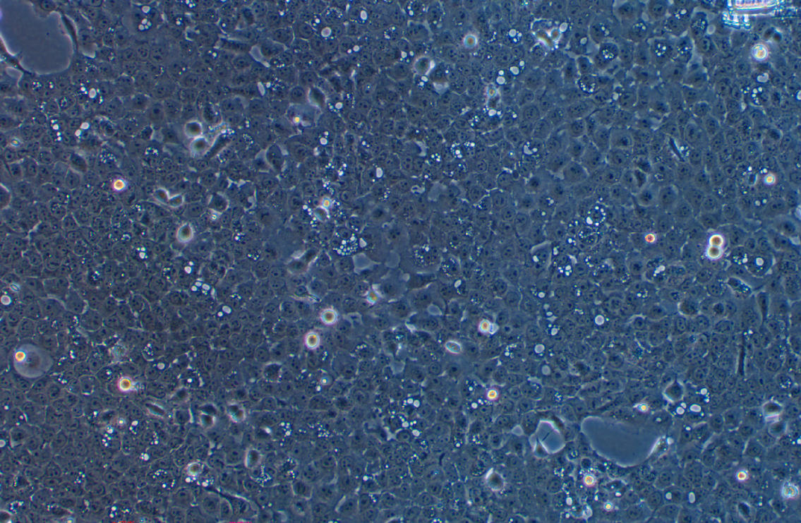 人口底鱗癌細胞UM-SCC-1(STR鑒定正確)