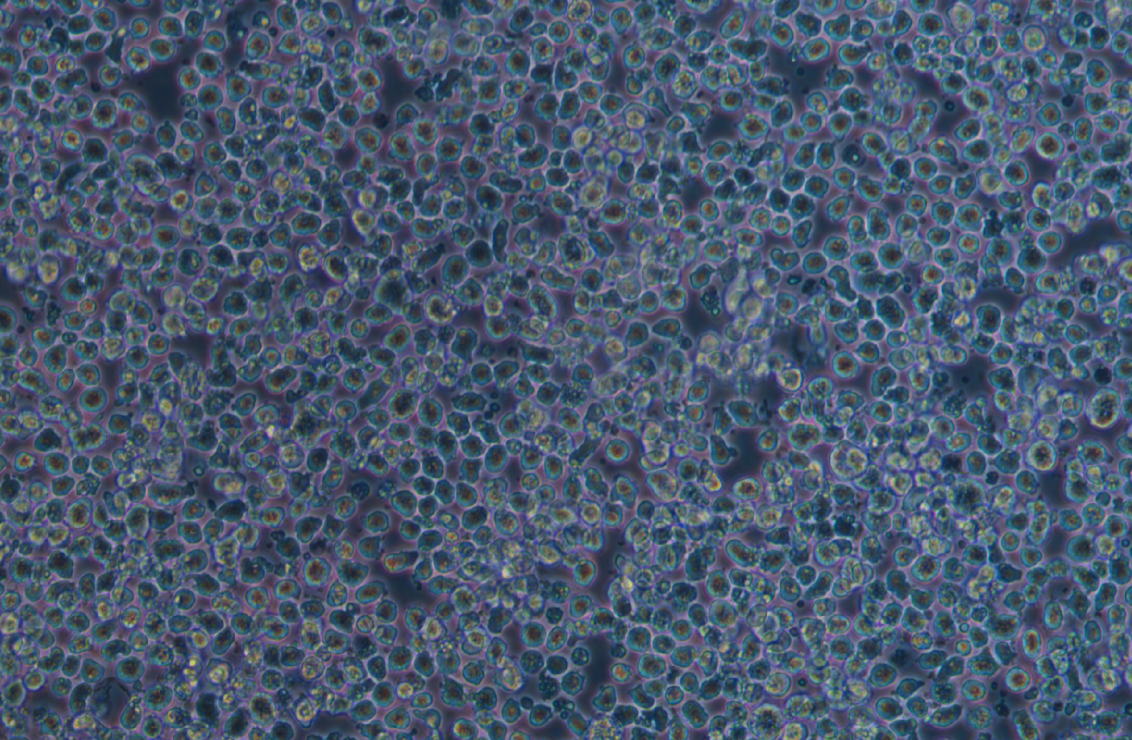 人巨細胞白血病細胞M-07e(STR鑒定正確)
