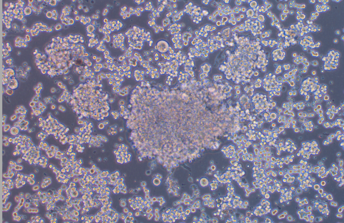 人小細胞肺癌細胞DMS79(STR鑒定正確)