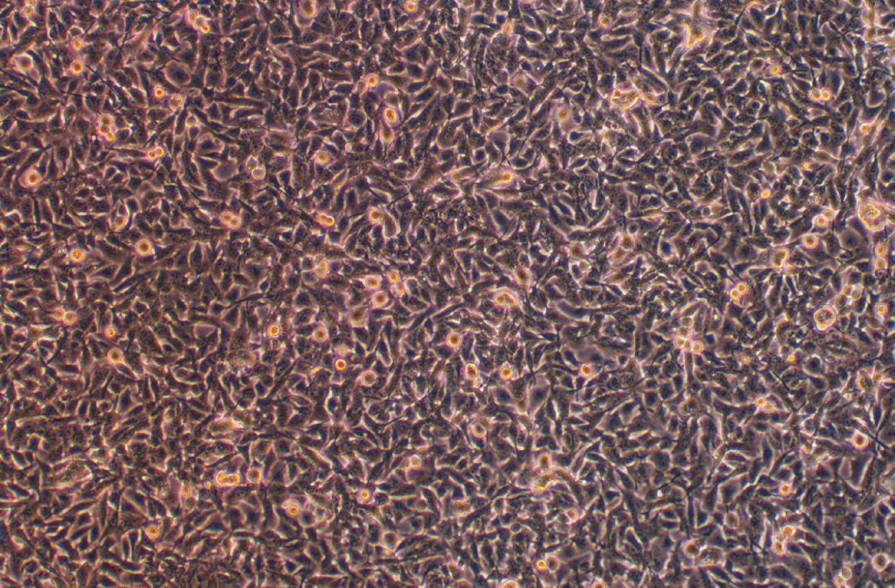 小鼠黑色素瘤細(xì)胞B16-F0(STR鑒定正確)