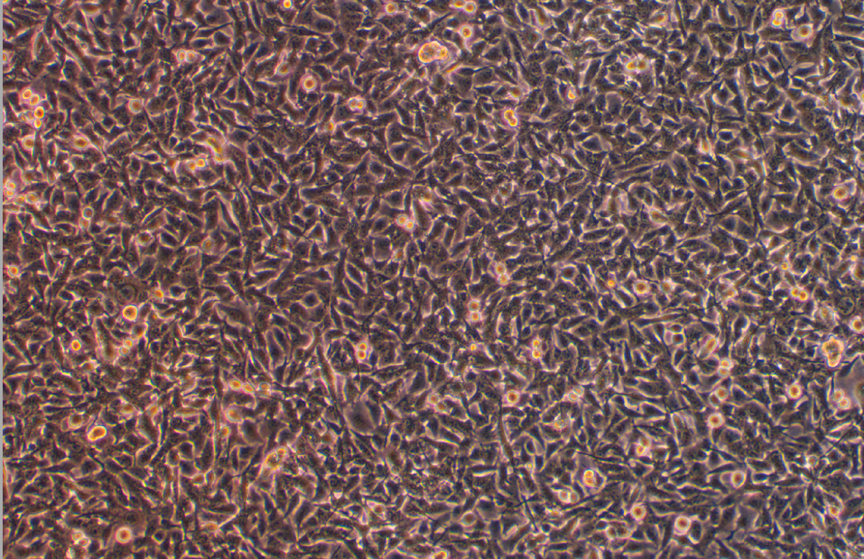 小鼠黑色素瘤細(xì)胞B16-F0(STR鑒定正確)