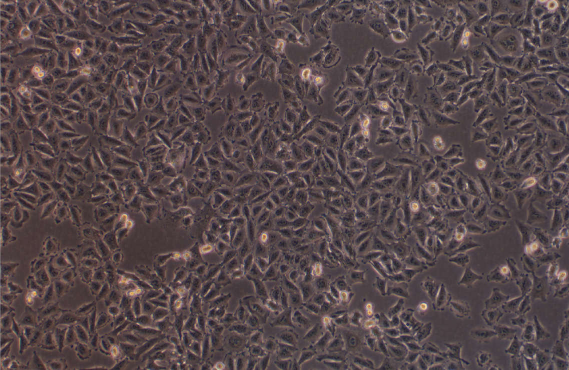 人黑色素瘤細胞株帶熒光素酶 A375+LUC(STR鑒定正確)