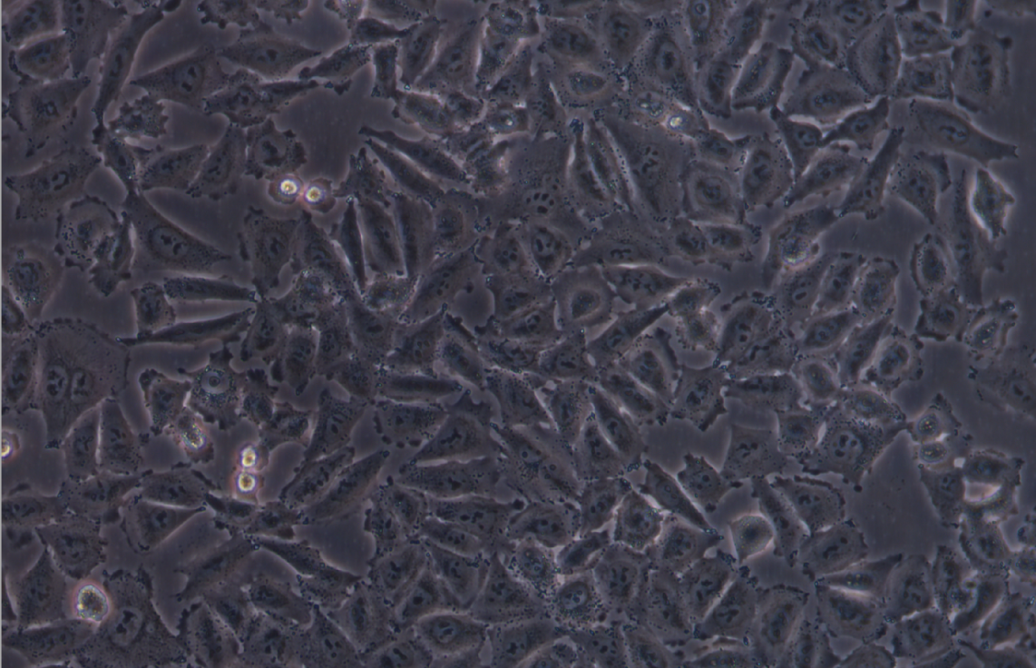 人黑色素瘤細胞株帶熒光素酶 A375+LUC(STR鑒定正確)