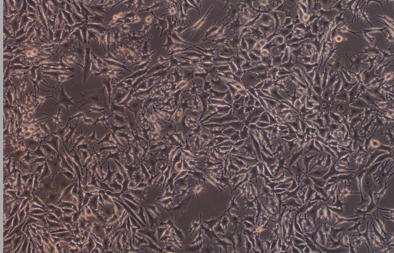 小鼠黑色素瘤細胞B16-F1(種屬鑒定)