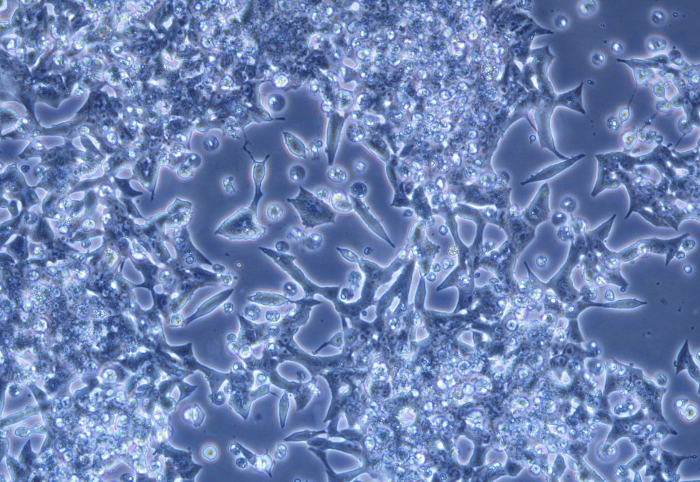 大鼠胰島細胞瘤細胞INS-1(種屬鑒定)