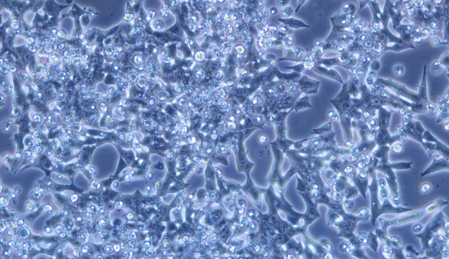 大鼠胰島細胞瘤細胞INS-1(種屬鑒定)