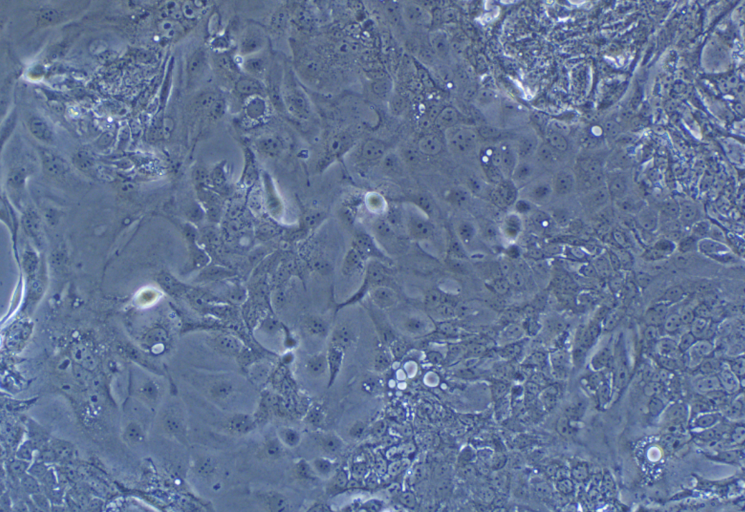 人大腸癌細胞SW1463