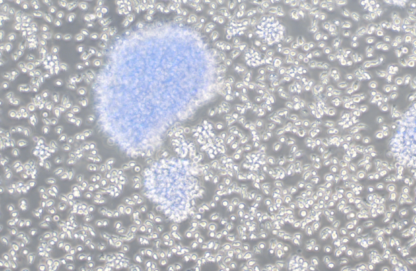 人淋巴母細胞系Dakiki (STR鑒定正確)