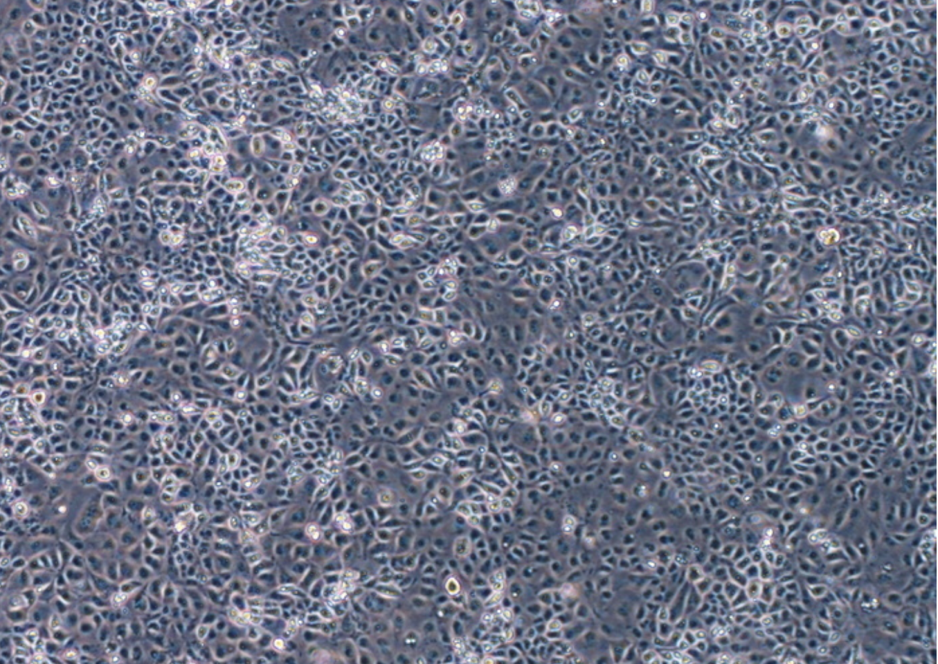 人肝癌細胞(未分化)HLE