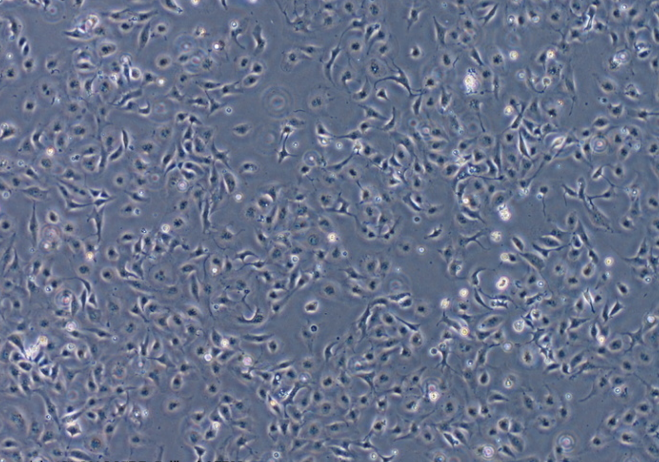 人肝癌細胞(未分化)HLE