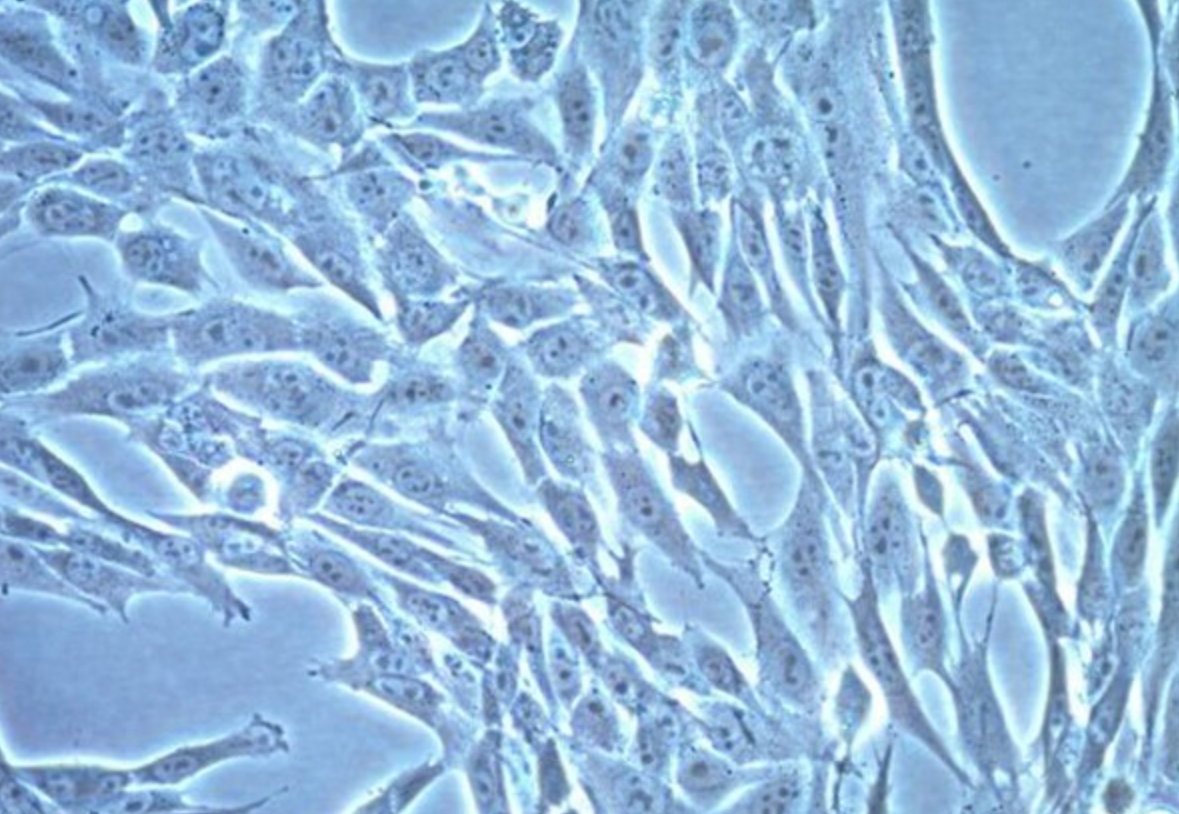 小鼠膠質母細胞瘤帶熒光素酶CT-2A+Luc(STR鑒定正確)