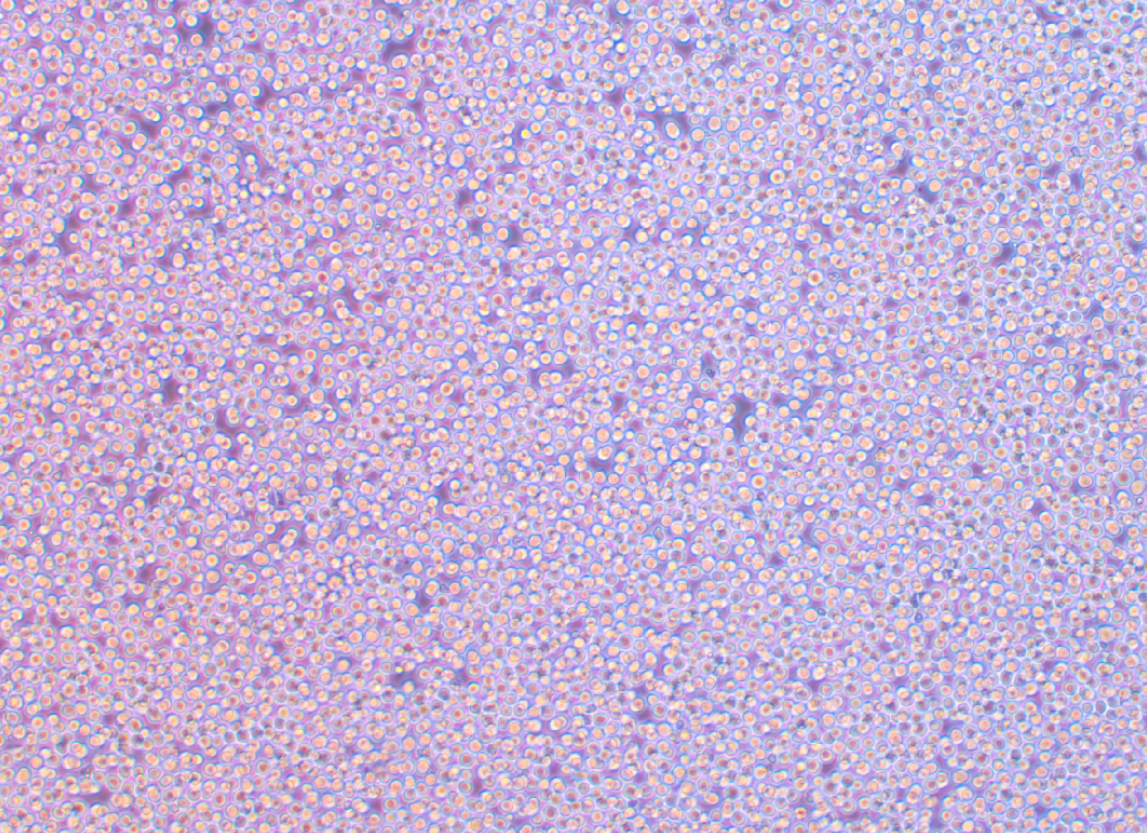 人慢性骨髓單核細胞性白血病MV-4-11(STR鑒定正確)