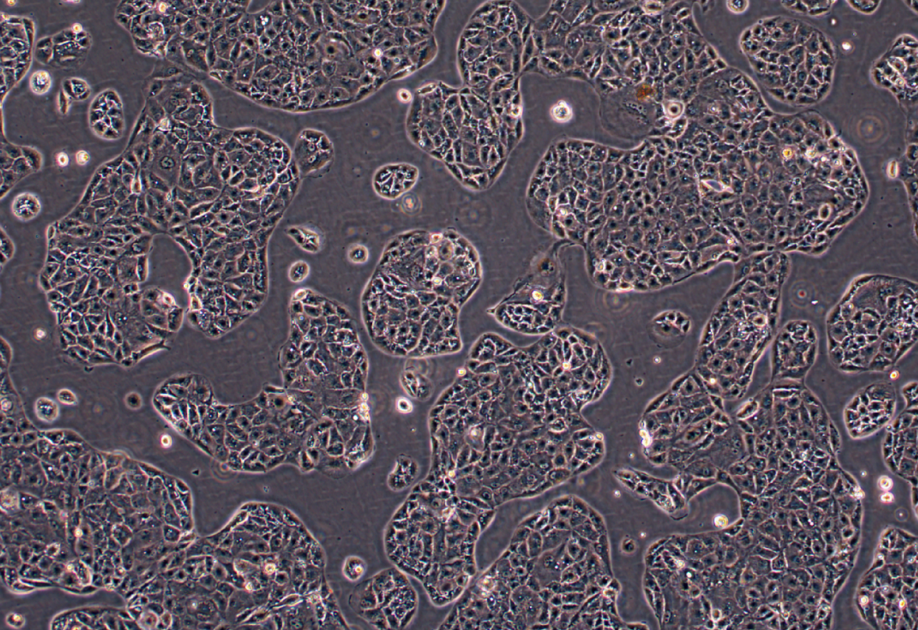人腎癌細胞A-704(STR鑒定正確)