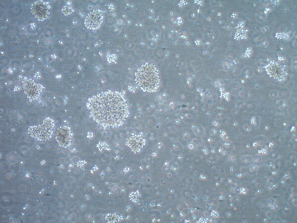 人B淋巴細(xì)胞母細(xì)胞LCL 721.221